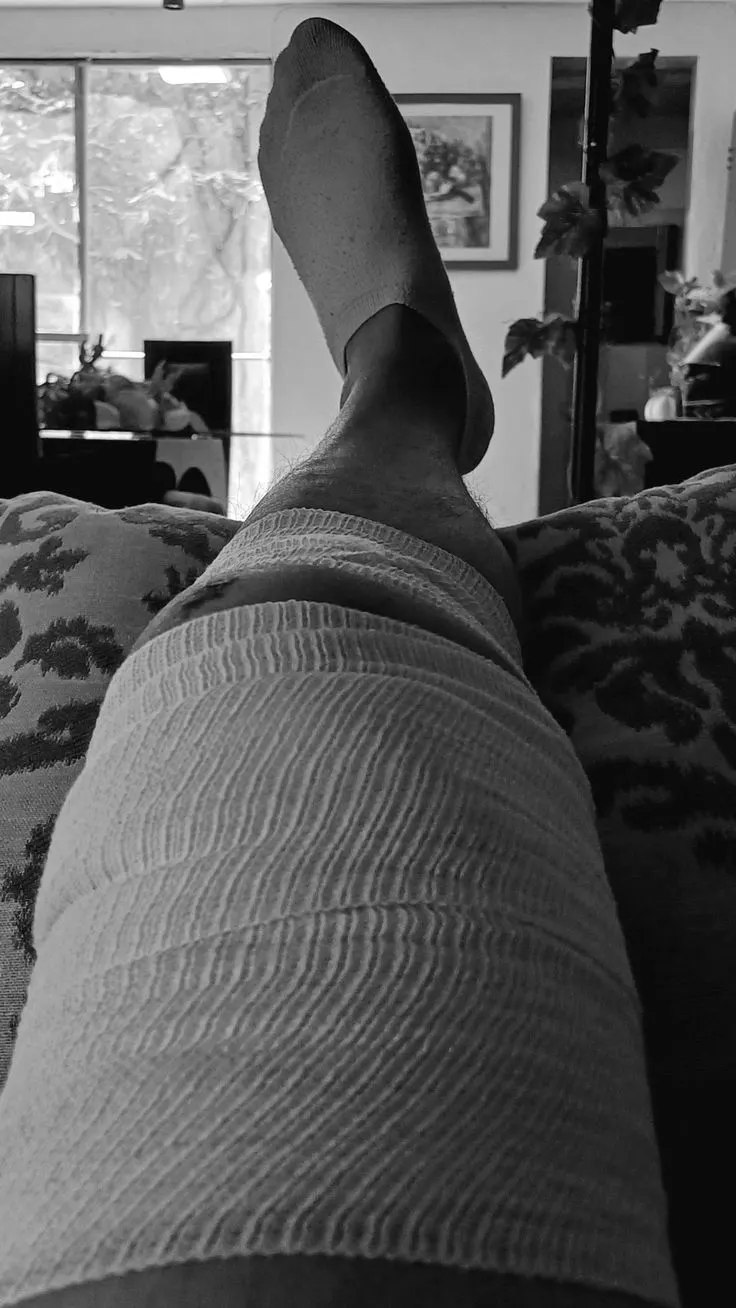 The knee ended it